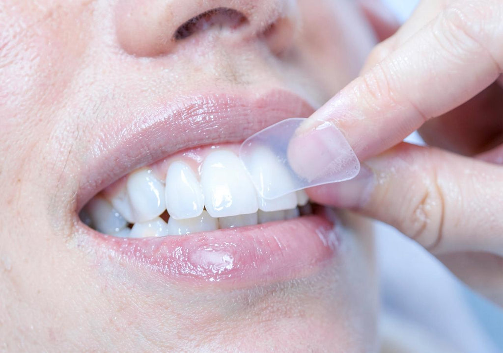 Applying a whitening strip to the upper teeth